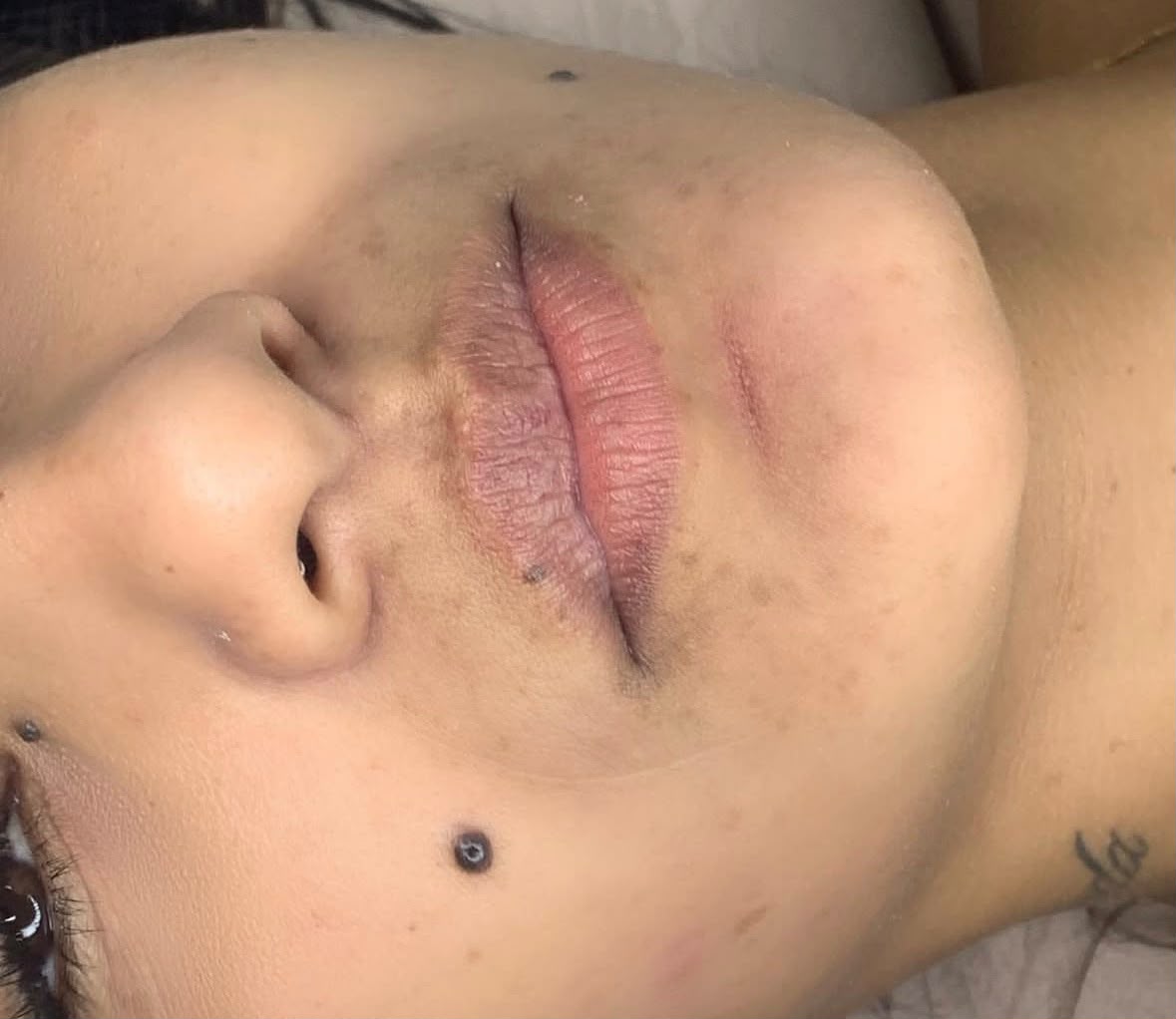 Nanopigmentação Labial — antes