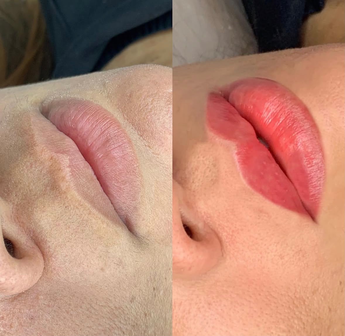 Nanopigmentação Labial — antes e depois